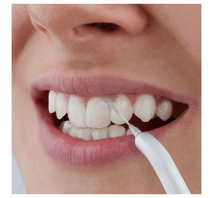 Ирригатор Sencor портативний, чаша 150 мл, Li-ion аккум. в компл., чехол, 10 насадок, белый